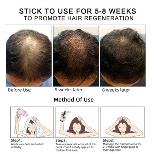 Hair Growth & Regrowth Oil – Natural Essential Oil for Thicker, Healthier Hair | Hair Care Solution