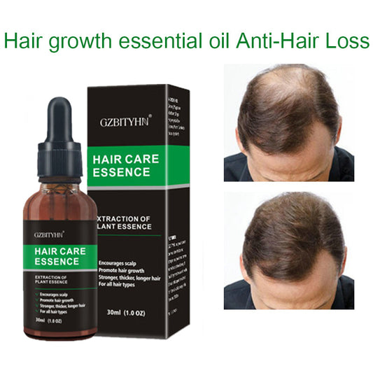 Hair Growth & Regrowth Oil – Natural Essential Oil for Thicker, Healthier Hair | Hair Care Solution